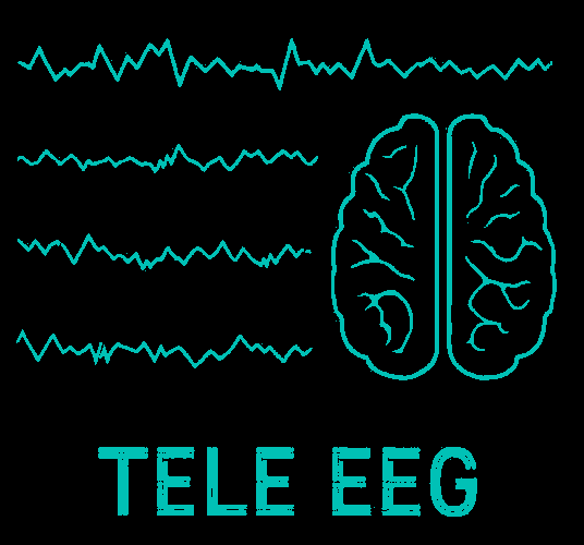 Tele EEG
